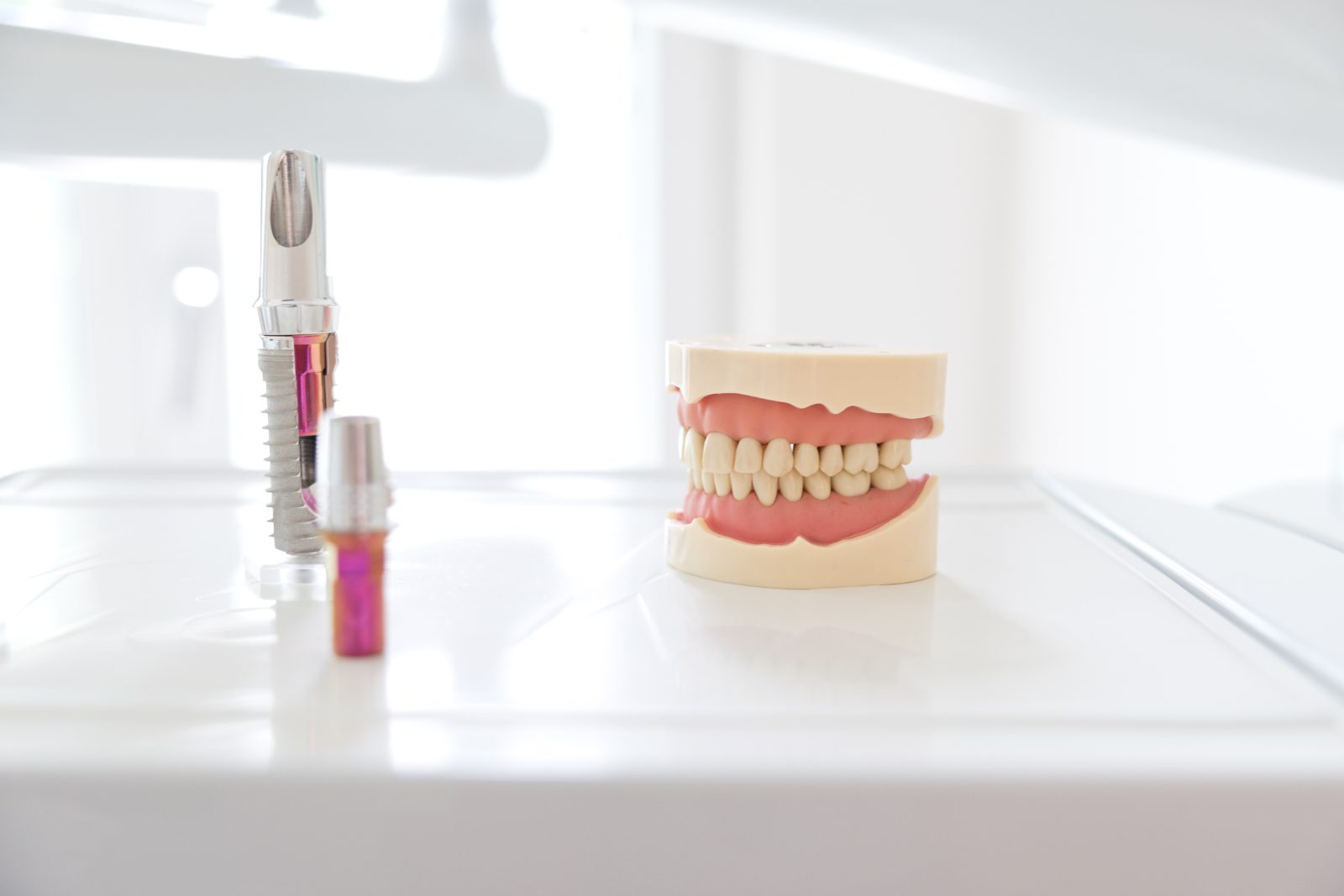 Modell eines Implantats in der Hand des Zahnarztes