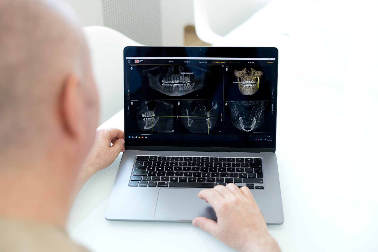 3D-Röntgenaufnahme in der Planungssoftware
